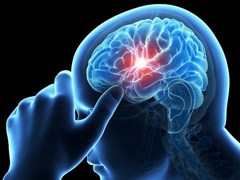 علامات وأعراض الورم الدموي الدماغي